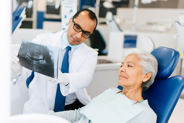 Dentist showing xray to mature woman in dental chair